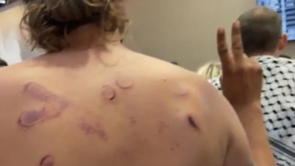Hematomas e fraturas: Ativistas da flotilha falam em tortura em Israel