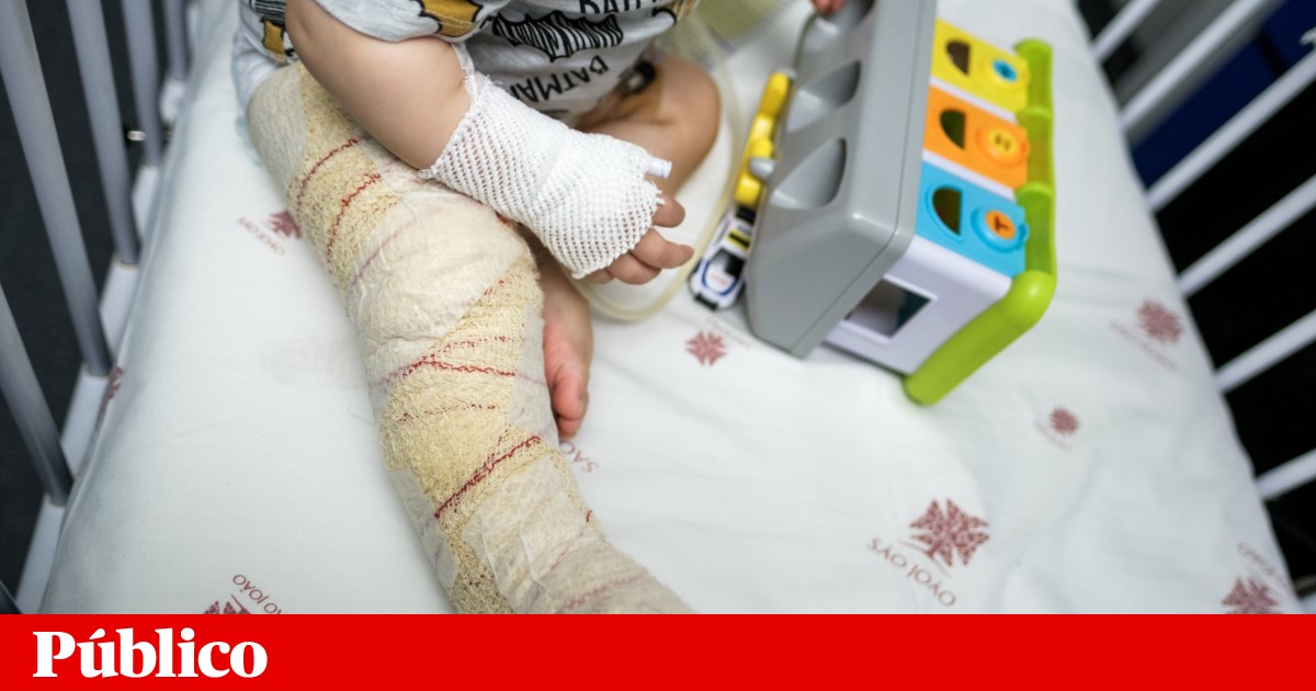 “É uma mochila muito pesada que carregamos a vida toda”: queimaduras continuam a levar crianças às urgências