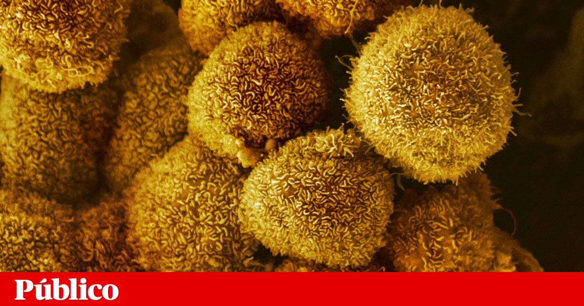 Vacinas contra cancro baseadas no ARNm avançam, apesar do corte de fundos nos EUA